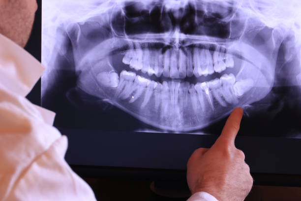 Best Emergency Root Canal Treatment in Kootenai, ID